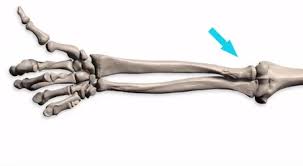 All land vertebrates have this bone. This Is What Happens To Your Ulna And Radius When You Turn Your Wrist Supination Pronation 9gag