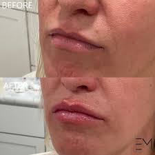 Christina made me feel very comfortable and she is very knowledgeable. I  really love that this place is in Hamilton as well!