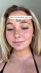 Tan Skin Permanently