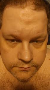 How Did Dave Blewins Die