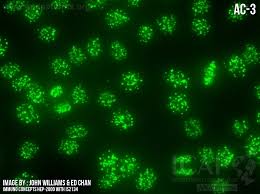 Image result for ANA Staining Pattern