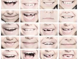 How to close gap in teeth yourself. Is It Normal For My Kid To Have Gaps Between His Her Teeth Blog Post Ismile Orthodontics Redmond Wa