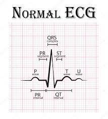 ECG normal (electrocardiograma) (onda P, segmento PR, intervalo PR,  complejo QRS, intervalo QT, segmento ST, onda T, onda U ) Vector de stock  #105838498 de ©stockdevil_666