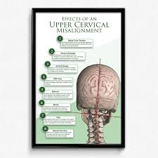Effects Of The Upper Cervical Misalignment Poster