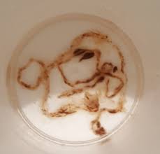 Drain flies are known for their love of moist environments. Worms In Toilet Abdominal Disorders Forums Patient