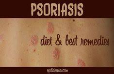 The Real Cause Of Psoriasis Your Dermatologist Isn T Telling You About Psoriasis Diet Psoriasis Cure Treat Psoriasis