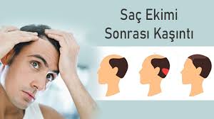 Sac Ekimi Sonrasi Kasinti Ve Sebepleri