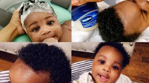 Cvs.com® is not available to customers or patients who are located outside of the united states or u.s. Baby Hair Care How I Got Rid Of My Baby Cradle Cap Using Vaseline Youtube
