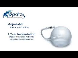 بالون الرشاقة سباتز الأمريكي Glance At Spatz Intra Gastric Balloon Youtube