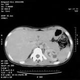 Image result