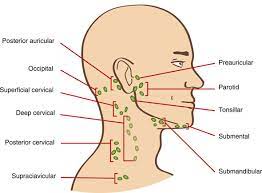 Geschwollener Lymphknoten Tonsillar Gesundheit Und Medizin Schwellung