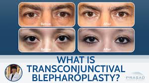 Image result for Blepharis transvaalensis