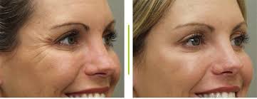 Ian Elder (@ianelder001)