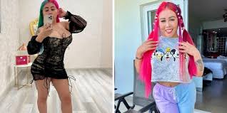 El doctor que operó la cola de yina calderon mostró imágenes del antes y después de la cirugía. Yina Calderon Tendra Que Hacerse Una Cirugia Para Extraer Biopolimeros
