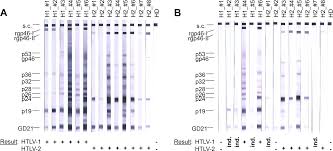 Posted by unknown on 08.52. Plos One No Significant Htlv Seroprevalence In German People Who Inject Drugs