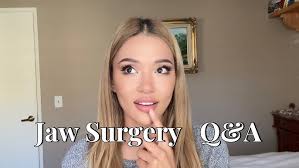 jaw surgery & other life updates