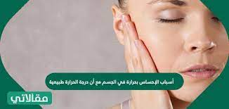 أسباب الإحساس بحرارة في الجسم مع أن درجة الحرارة طبيعية مقالاتي