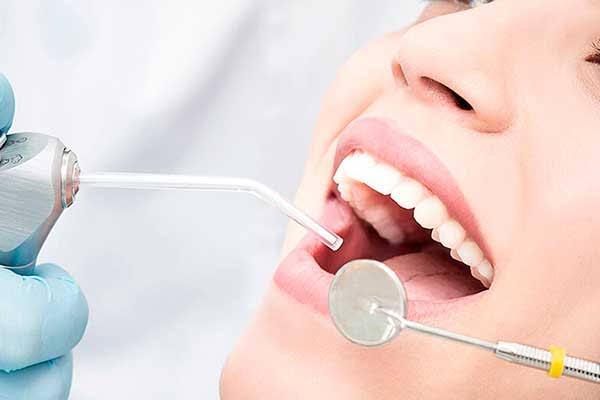 A Dental Filling Might Be Used in Cavity Treatment - Dental Resort