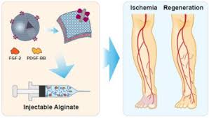 Syndecan-4 proteoliposomes enhance revascularization in a rabbit hind limb  ischemia model of peripheral ischemia