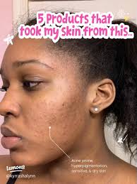 60 top Skincare Routine for Sensitive Skin with Dark Spots ideas in 2025