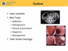 Image result for Neutropenic Colitis