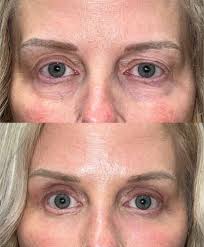 Image result for Blepharis transvaalensis