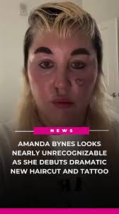 Dramatic Transformation of Amanda Bynes: Updates Revealed