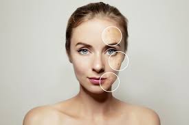 Eine studie von 2008, an der mehr als 1.000 frauen teilnahmen, geht davon aus, dass ungefähr 45 % der frauen zwischen 20 und 39 jahren Akne Ursachen Symptome Behandlung Hautarztzentrum Kiel