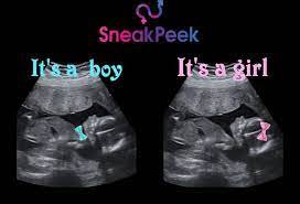 This way, it is easy to find a place near your area. Home Anticipation Ultrasound Studio