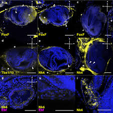 In the future pouring out of god's wrath in the tribulation, even after the horrible plagues the earth dwellers did not repent of their murders. Expression Of Tfs Heart Development Related Revealed By Fish A C Download Scientific Diagram