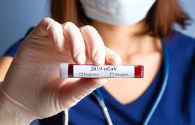 Sie können direkt nach dem test das testzentrum verlassen. First High Volume Covid 19 Antigen Test Receives Fda Emergency Use Authorization New Jersey Business Magazine