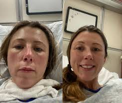 Volunteer with AiArthritis