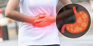 Berikut beberapa nama lain narkoba amfetamin red ice adalah jenis narkoba amfetamin yang telah beredar di indonesia. Penyakit Gerd Bisa Berkembang Jadi Kanker Esofagus Apa Itu