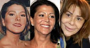Rostro de alejandra guzmán desata memes en redes sociales. Asi Ha Evolucionado El Rostro De Alejandra Guzman Con El Paso De Los Anos Actitudfem