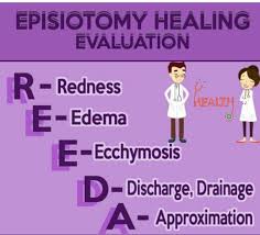 Episiotomy Healing Evaluation Nursing Notes Healing Nursing School