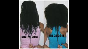 Biotin supplements(affiliate link) are available in pharmacies with doses beginning with 5000mcg per day, as with fingernails. Natural Hair Biotin Review 2 Months Youtube