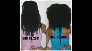 Biotin supplements(affiliate link) are available in pharmacies with doses beginning with 5000mcg per day, as with fingernails. Natural Hair Biotin Review 2 Months Youtube