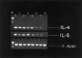 Twój czar nade mną trwa: Th2 Like Cytokine Activity In Dermatitis Herpetiformis Caproni 1998 British Journal Of Dermatology Wiley Online Library
