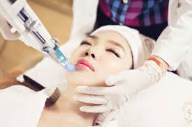 Cấy tế bào gốc