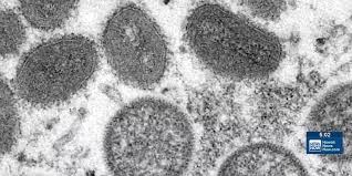 DOH detected Mpox in Oahu wastewater sample