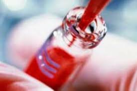 El incremento de glóbulos blancos en sangre es lento y progresivo, generalmente a. Conoce Los Sintomas De La Leucemia Y Como Detectarlo Noticias Agencia Peruana De Noticias Andina