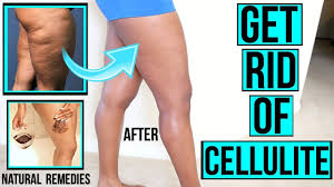 Free shipping over $40 · 10% off for first order · use code beauty10 How To Get Rid Of Cellulite Fast Naturally Diy At Home Scrubs Mixes Youtube