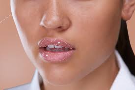 Revanesse® lips™+ is an fda approved hyaluronic acid dermal filler that can be used for submucosal. Lip Injections 9 Things I Wish I D Known Before Getting Them Glamour