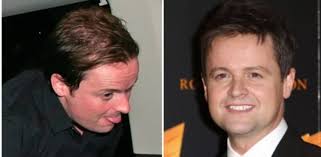 Or is the left photo — which shows him with kinda thinner hair — just a case of focused lighting and camera angle? 32 Celebrity Men Who Miraculously Have More Hair Dr Hair Usa