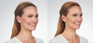 Fillers and Injectables