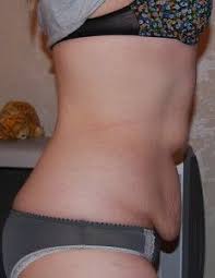 Pin On Health True Health You