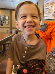 Wiggly teeth in 5-year-olds, how to handle?