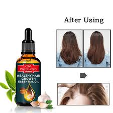 Your hair will become healthy if you use garlic essential oil for your hair's health. 50ml Garlic Hair Growth Oil Anti Hair Loss Hair Regrowth Herbal Essential Oil Hair Growth Care Products New Hair Loss Products Aliexpress