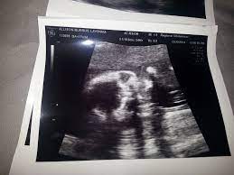 pin on pregnancy parenting tips