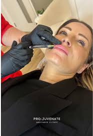 B e f o r e & A f t e r ✨ Balanced, defined, and beautifully enhanced!...